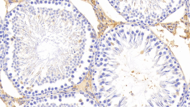 PZP Antibody in Immunohistochemistry (Paraffin) (IHC (P))