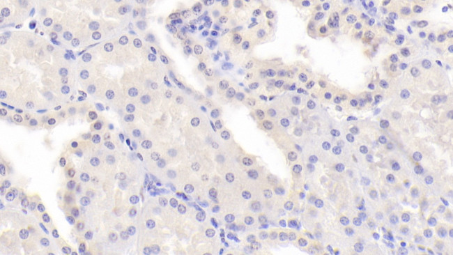 PDCD6 Antibody in Immunohistochemistry (Paraffin) (IHC (P))