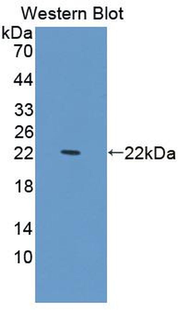 PDCD6 Antibody in Western Blot (WB)