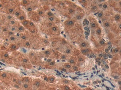 Prohibitin Antibody in Immunohistochemistry (Paraffin) (IHC (P))