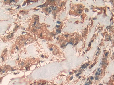 Prohibitin Antibody in Immunohistochemistry (Paraffin) (IHC (P))