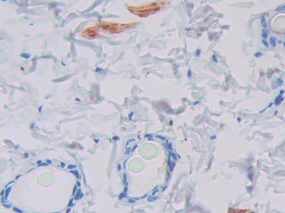 GCDFP-15 Antibody in Immunohistochemistry (Paraffin) (IHC (P))