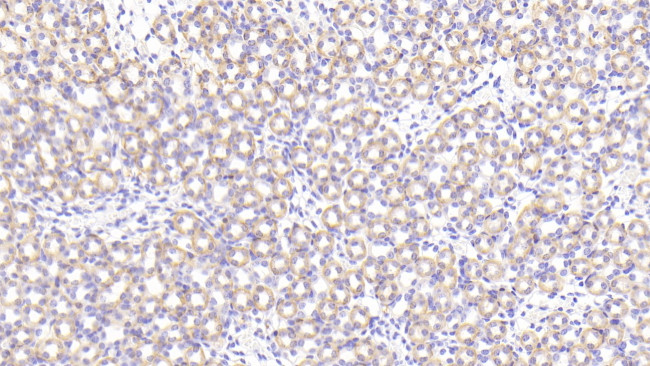 PRCP Antibody in Immunohistochemistry (Paraffin) (IHC (P))