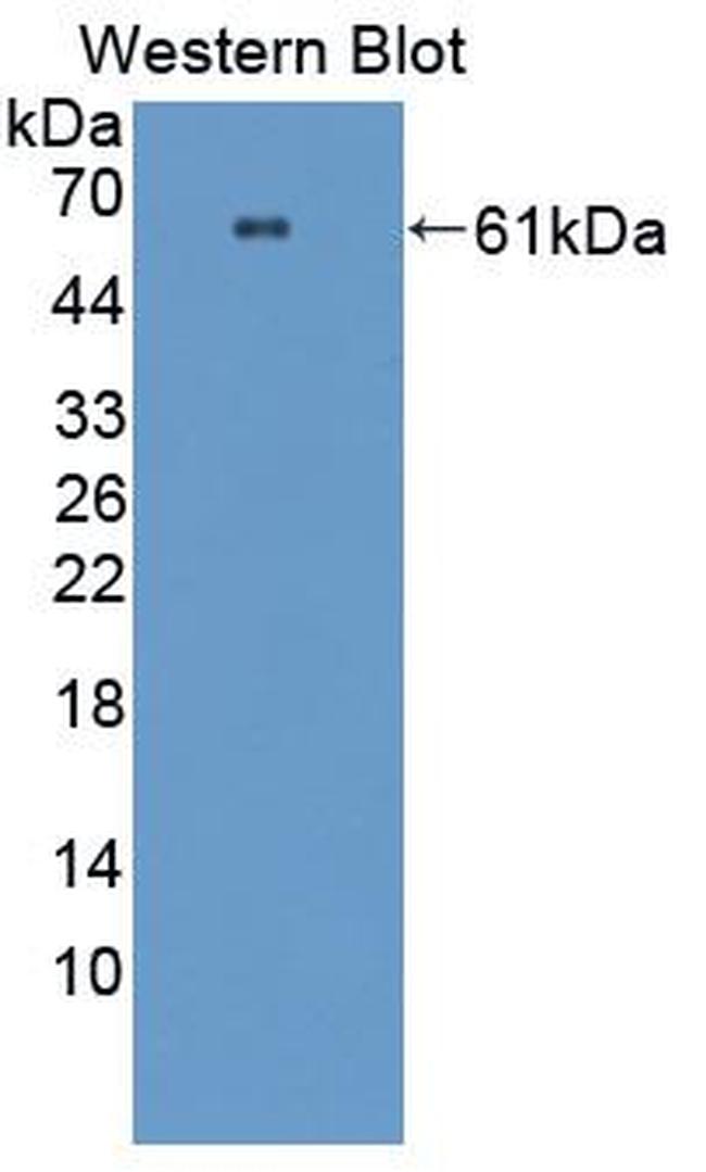 PRCP Antibody in Western Blot (WB)