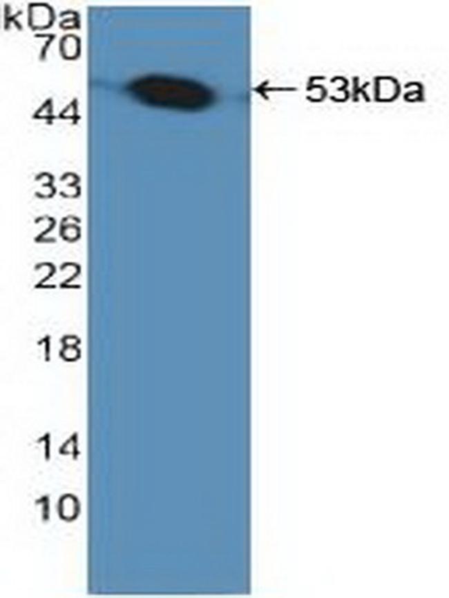 PSMC1 Antibody in Western Blot (WB)