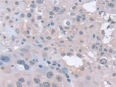 PSMA5 Antibody in Immunohistochemistry (Paraffin) (IHC (P))