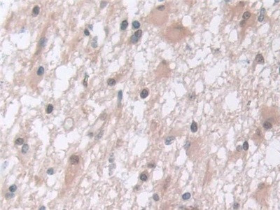 PSMA5 Antibody in Immunohistochemistry (Paraffin) (IHC (P))