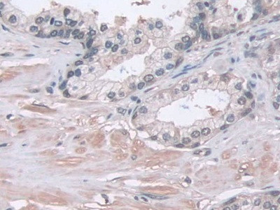 PSMA5 Antibody in Immunohistochemistry (Paraffin) (IHC (P))