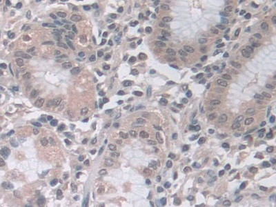 PSMA5 Antibody in Immunohistochemistry (Paraffin) (IHC (P))