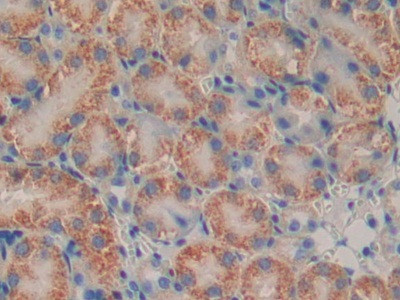 PSMB9 Antibody in Immunohistochemistry (Paraffin) (IHC (P))