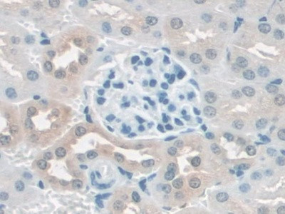 SCAF11 Antibody in Immunohistochemistry (Paraffin) (IHC (P))