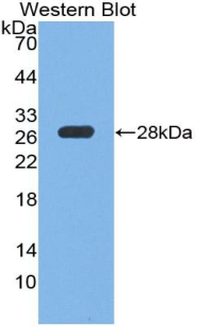 PTPRS Antibody in Western Blot (WB)