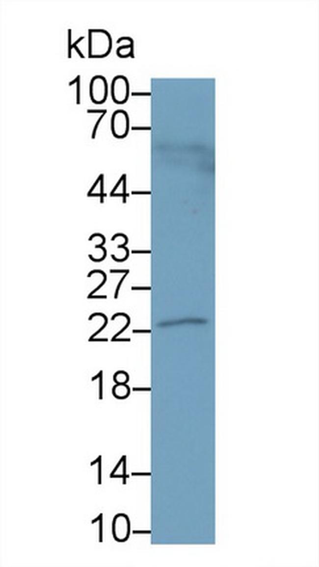 PRL3 Antibody in Western Blot (WB)