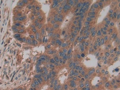 PKM2 Antibody in Immunohistochemistry (Paraffin) (IHC (P))