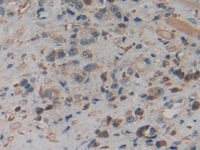 PKM2 Antibody in Immunohistochemistry (Paraffin) (IHC (P))