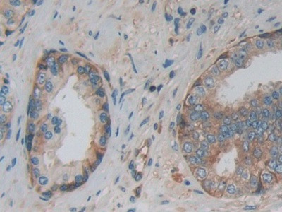 PKM2 Antibody in Immunohistochemistry (Paraffin) (IHC (P))