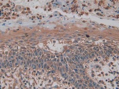 PKM2 Antibody in Immunohistochemistry (Paraffin) (IHC (P))