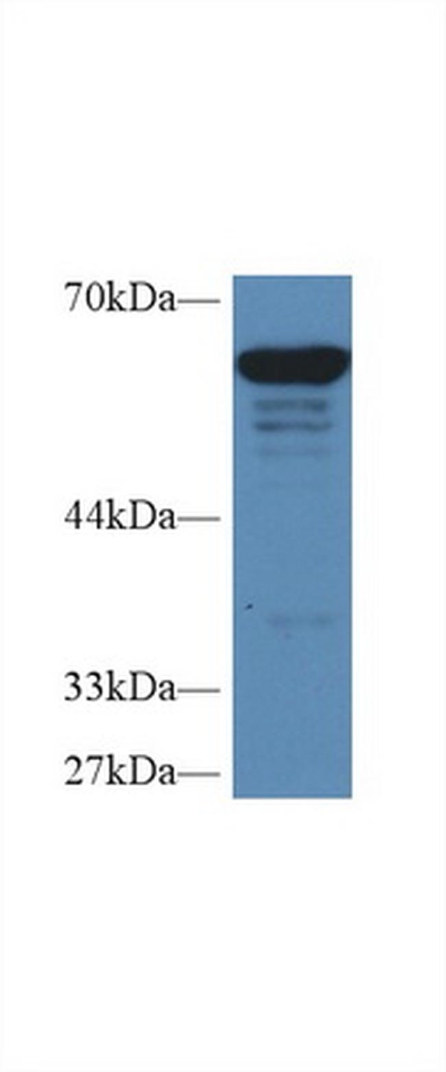 PKM2 Antibody in Western Blot (WB)