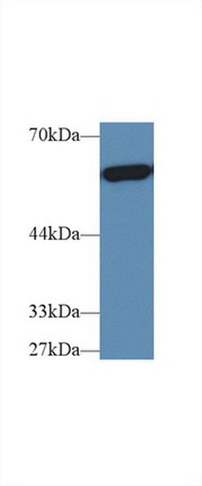 PKM2 Antibody in Western Blot (WB)