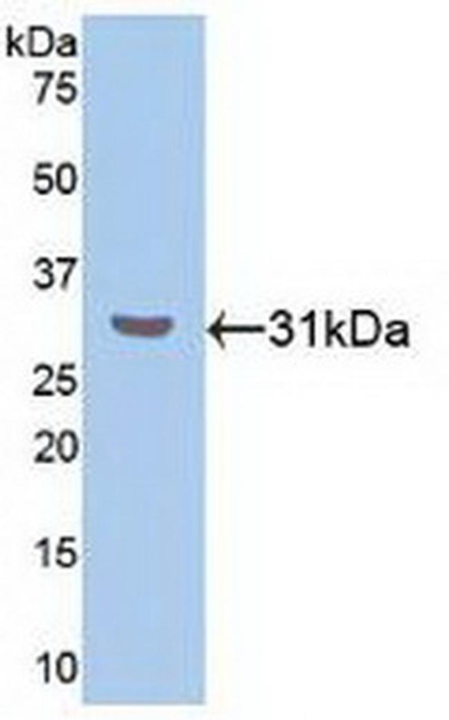 RORA Antibody in Western Blot (WB)