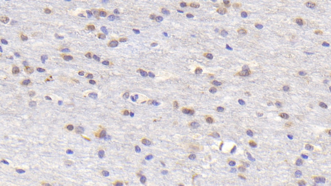 RANK (CD265) Antibody in Immunohistochemistry (Paraffin) (IHC (P))