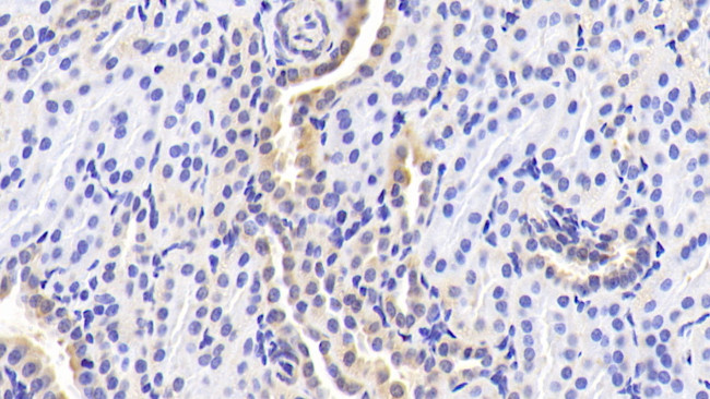 RANK (CD265) Antibody in Immunohistochemistry (Paraffin) (IHC (P))