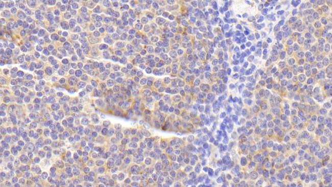 RANK (CD265) Antibody in Immunohistochemistry (Paraffin) (IHC (P))