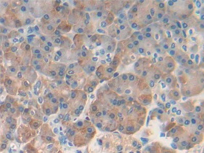 REG1B Antibody in Immunohistochemistry (Paraffin) (IHC (P))