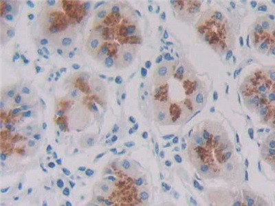 REG1B Antibody in Immunohistochemistry (Paraffin) (IHC (P))