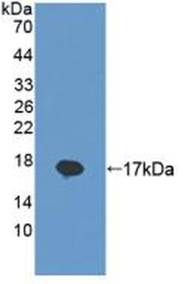 REG1B Antibody in Western Blot (WB)