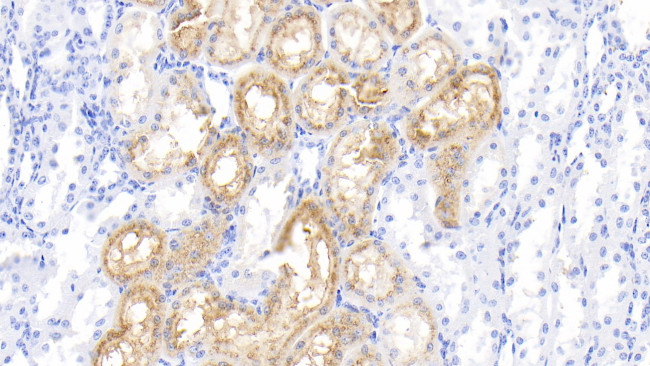 RBP4 Antibody in Immunohistochemistry (Paraffin) (IHC (P))