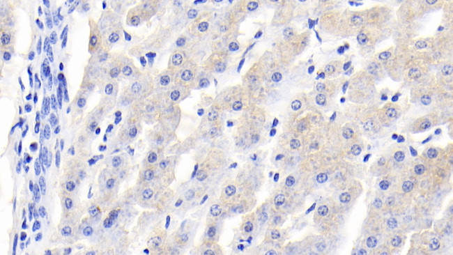 RBP4 Antibody in Immunohistochemistry (Paraffin) (IHC (P))