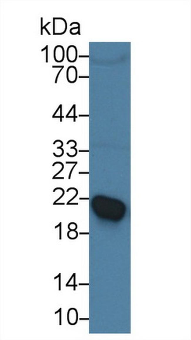 RBP4 Antibody in Western Blot (WB)