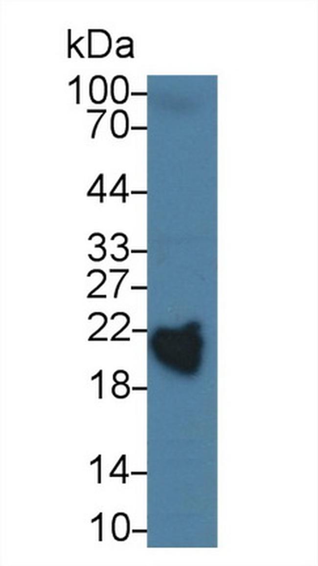 RBP4 Antibody in Western Blot (WB)