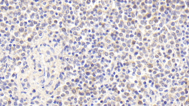 RNASEH2A Antibody in Immunohistochemistry (Paraffin) (IHC (P))