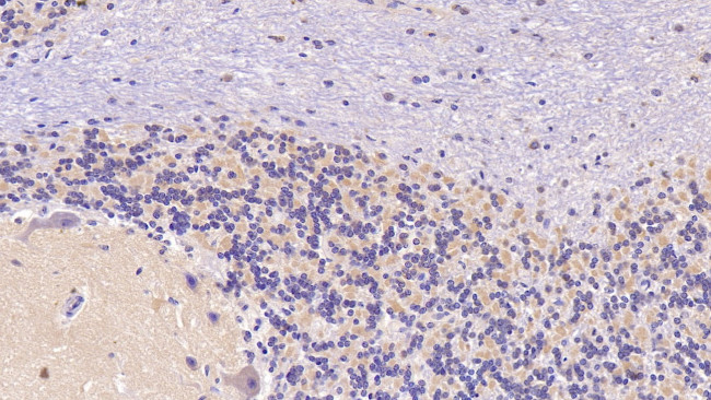 SEMA5B Antibody in Immunohistochemistry (Paraffin) (IHC (P))