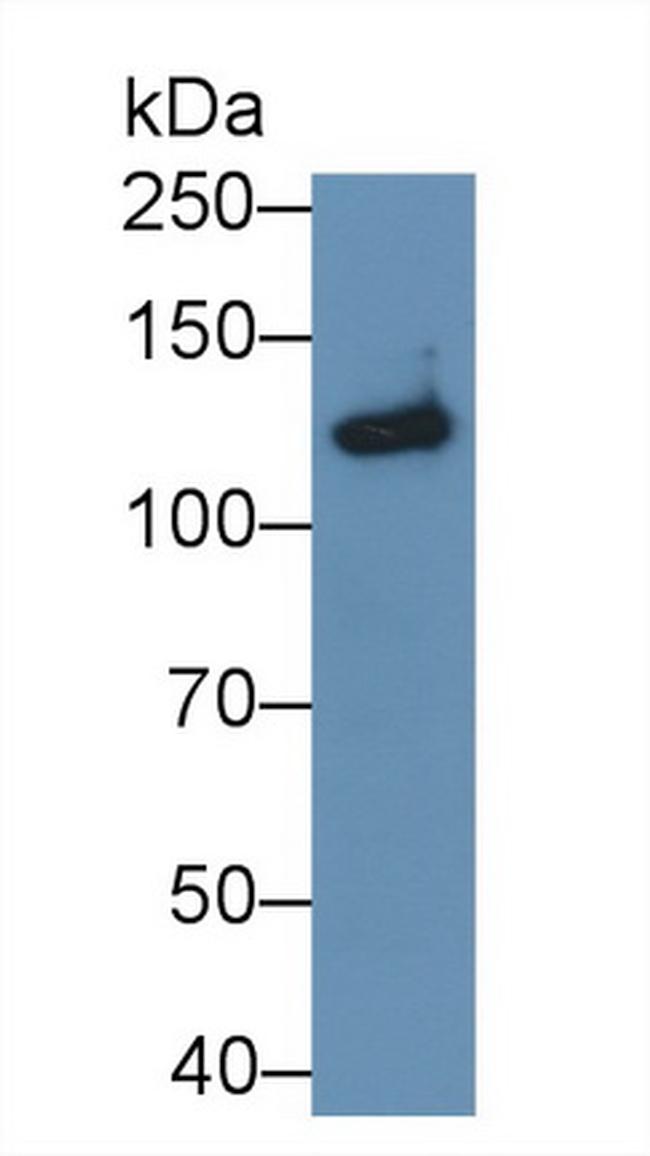 SEMA5B Antibody in Western Blot (WB)