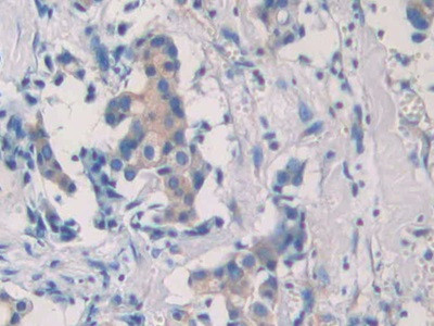 SEPT5 Antibody in Immunohistochemistry (Paraffin) (IHC (P))