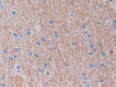 SHMT2 Antibody in Immunohistochemistry (Paraffin) (IHC (P))