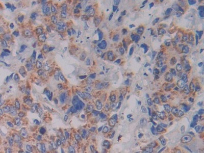 SHMT2 Antibody in Immunohistochemistry (Paraffin) (IHC (P))