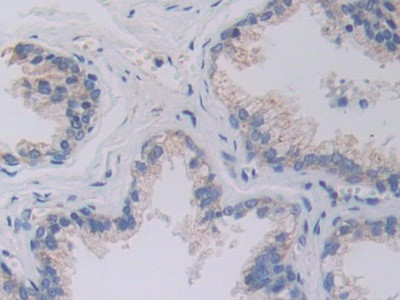 SHMT2 Antibody in Immunohistochemistry (Paraffin) (IHC (P))