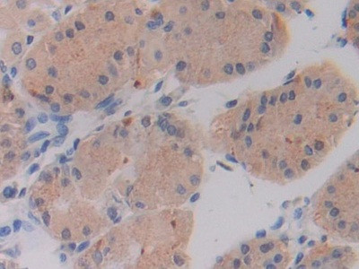 SHMT2 Antibody in Immunohistochemistry (Paraffin) (IHC (P))