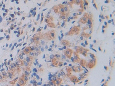 SHMT2 Antibody in Immunohistochemistry (Paraffin) (IHC (P))