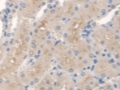 SPTLC1 Antibody in Immunohistochemistry (Paraffin) (IHC (P))