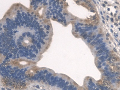 SPTLC1 Antibody in Immunohistochemistry (Paraffin) (IHC (P))