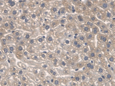 SPTLC1 Antibody in Immunohistochemistry (Paraffin) (IHC (P))