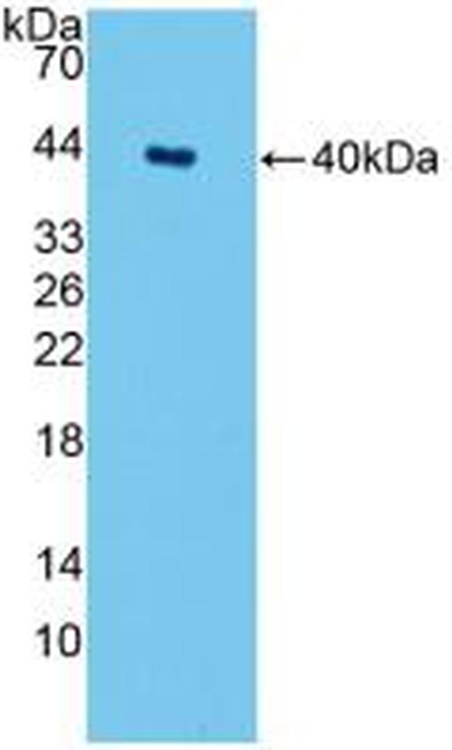 SPTLC1 Antibody in Western Blot (WB)