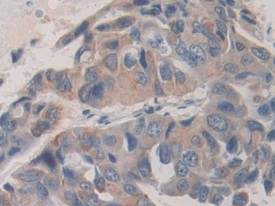 SHC3 Antibody in Immunohistochemistry (Paraffin) (IHC (P))