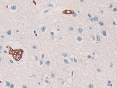 SHC3 Antibody in Immunohistochemistry (Paraffin) (IHC (P))