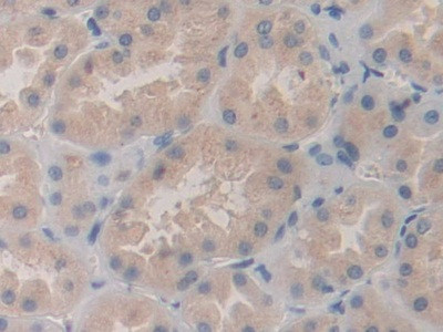 SHC3 Antibody in Immunohistochemistry (Paraffin) (IHC (P))